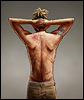 scars
